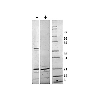 Human TRAIL Recombinant Protein