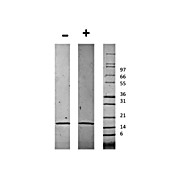 Human Chemerin Recombinant Protein