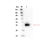 Anti-ALPHA-1-ACID GLYCOPROTEIN (Human Plasma) (RABBIT) Antibody