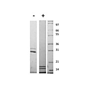 Mouse Interleukin-17AF Heterodimer Recombinant Protein