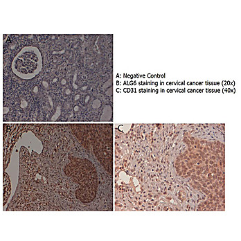 Anti-ALG6 (RABBIT) Antibody