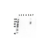 Anti-HbS (MOUSE) Monoclonal Antibody