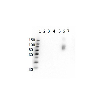 Anti-HbS (MOUSE) Monoclonal Antibody