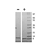 Mouse Monocyte Chemotactic Protein-2 (CCL8) Recombinant Protein