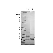 Human RELM beta Recombinant Protein