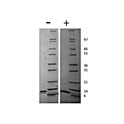 Mouse IP-10 (CXCL10) Recombinant Protein