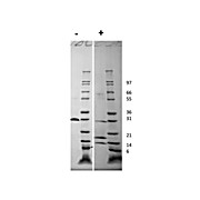 Human Platelet Derived Growth Factor-AB Recombinant Protein