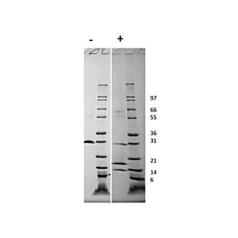 Human Platelet Derived Growth Factor-AB Recombinant Protein