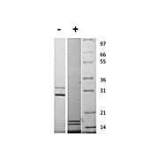 Rat Interleukin-17AF Heterodimer Recombinant Protein