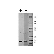 Mouse Stromal Cell-Derived Factor-1 beta (CXCL12) Recombinant Protein