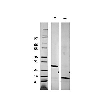 Human Growth and Differentiation Factor-5 Recombinant Protein