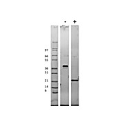 Mouse Vascular Endothelial Growth Factor-165 Recombinant Protein