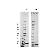 Human Monocyte Chemotactic Protein-2 (CCL8) Recombinant Protein