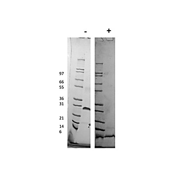 Human Platelet Derived Growth Factor-BB Recombinant Protein