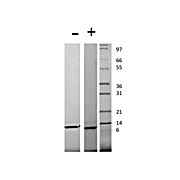 Human Monocyte Chemotactic Protein-4 (CCL13) Recombinant Protein