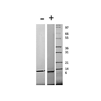 Human Monocyte Chemotactic Protein-4 (CCL13) Recombinant Protein