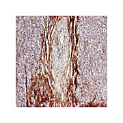 Anti-Osteopontin (RABBIT) Antibody