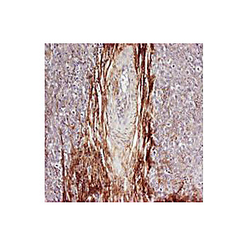 Anti-Osteopontin (RABBIT) Antibody