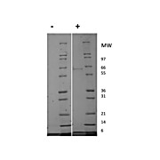 Human Insulin-like Growth Factor I Recombinant Protein (Animal Free)