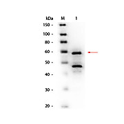 Anti-BILIRUBIN OXIDASE (Myrothecium verrucaria) (GOAT) Antibody Biotin Conjugated