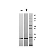 Human Monocyte Chemotactic Protein-3 (CCL7) Recombinant Protein
