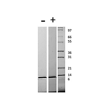 Human Monocyte Chemotactic Protein-3 (CCL7) Recombinant Protein