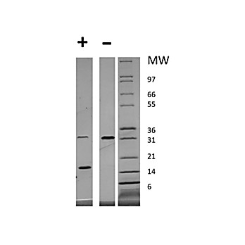 Human Platelet Derived Growth Factor-AA Recombinant Protein