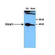 Anti-HICE1 (Rabbit) Antibody