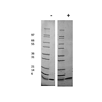 Mouse Insulin-like Growth Factor I Recombinant Protein