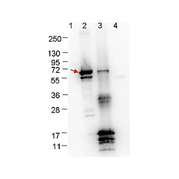 Anti-ErpN/OspE (RABBIT) Antibody