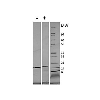 Human Interleukin-21 Recombinant Protein (Animal Free)