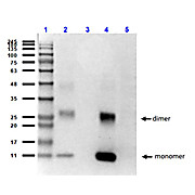 Anti-HbA (MOUSE) Monoclonal Antibody