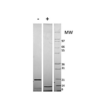 Mouse Resistin Dimer Recombinant Protein