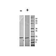 Human Flt-3 Ligand Recombinant Protein