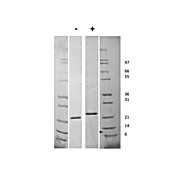 Human Fibroblast Growth Factor-21 Recombinant Protein