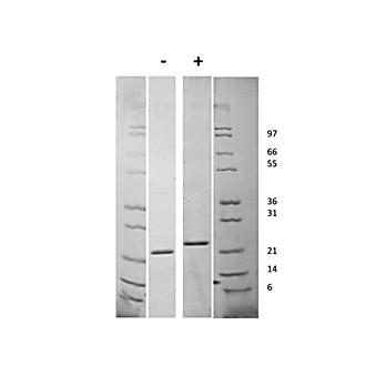 Human Fibroblast Growth Factor-21 Recombinant Protein