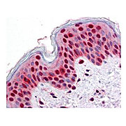 Anti-STAT2 (MOUSE) Monoclonal Antibody