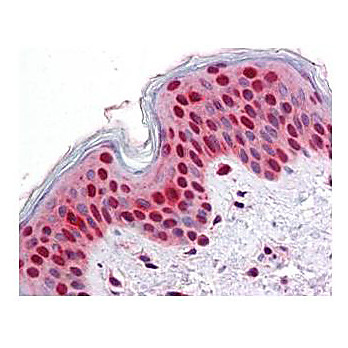 Anti-STAT2 (MOUSE) Monoclonal Antibody