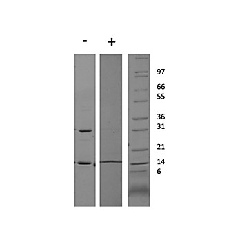 Rat Interferon gamma Recombinant Protein