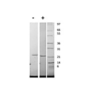 Human Interleukin-11 Recombinant Protein