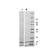 Mouse Interleukin IL-31 Recombinant Protein