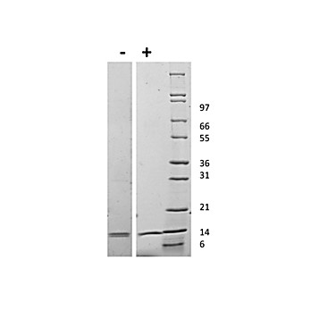 Mouse Interleukin IL-31 Recombinant Protein
