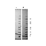 Human Stromal Cell-Derived Factor-1 alpha (CXCL12) Recombinant Protein