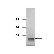 Anti-ALDOLASE [Rabbit Muscle] (GOAT) Antibody