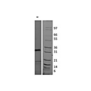 Human Interleukin-17E (IL-25) Recombinant Protein