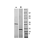 Human Macrophage Colony Stimulating Factor Recombinant Protein