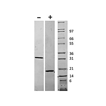 Human Macrophage Colony Stimulating Factor Recombinant Protein