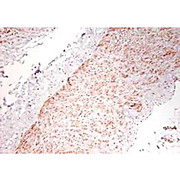 Anti-Human TNF alpha (RABBIT) Antibody