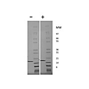 Human Tumor Necrosis Factor alpha Recombinant Protein (Animal Free)