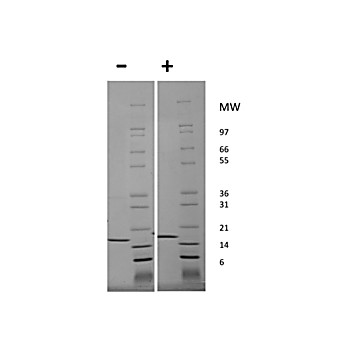 Human Tumor Necrosis Factor alpha Recombinant Protein (Animal Free)